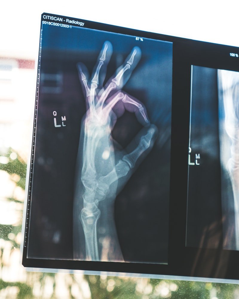 X-Ray Technician Practical Training at TMIPS Jamshedpur